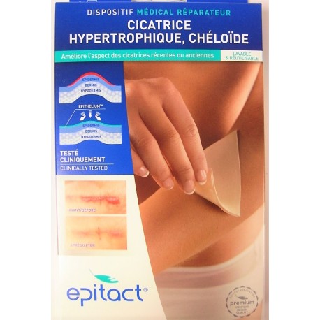 Epitact - Cicatrice hypertrophique, chéloïde